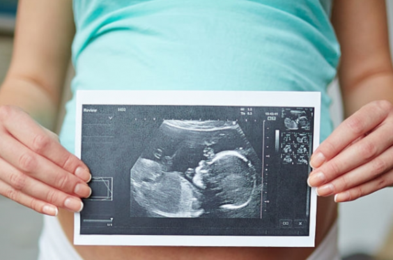 close up of pregnant woman holding ultrasound of baby over belly