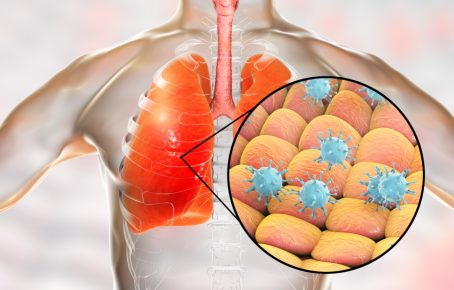 Coronavirus in lung
